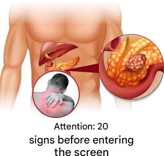 13298098 eb0d 4a1d 8b93 777f21a2a33e