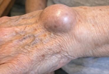 FB IMG 1772150598923