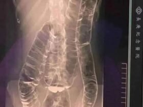 495168660 122135942684648101 6973593104301750494 n