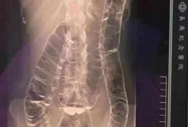 495168660 122135942684648101 6973593104301750494 n