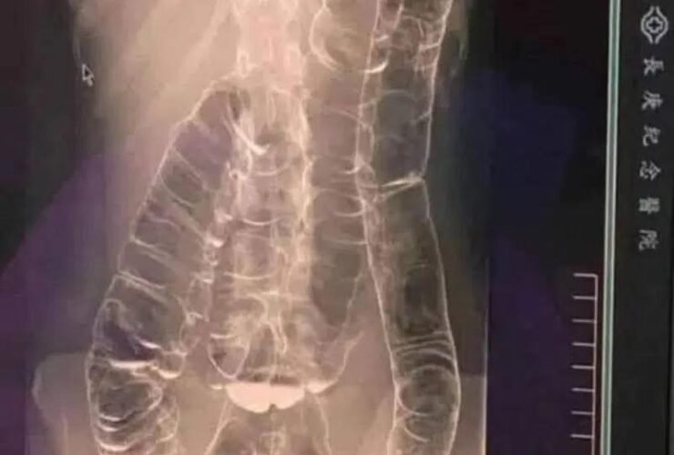 495168660 122135942684648101 6973593104301750494 n