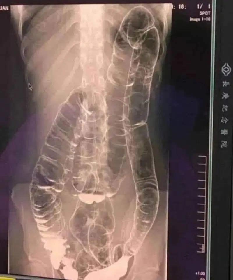 495168660 122135942684648101 6973593104301750494 n